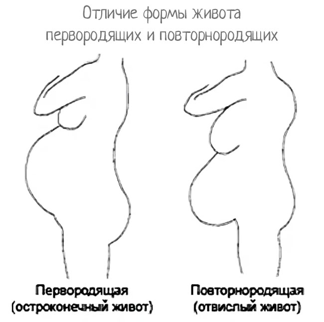 Расположение живота при беременности мальчиком и девочкой картинки