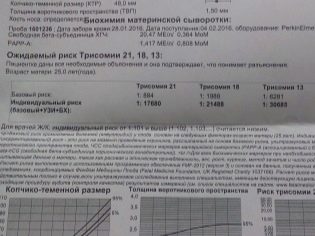 Показатели трисомии 13. Трисомия 13 нормальные показатели. Трисомия 21 скрининг. Риски трисомии.