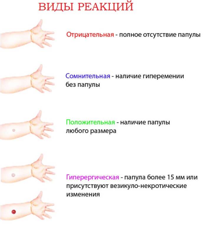 Какая должна быть прививка фото