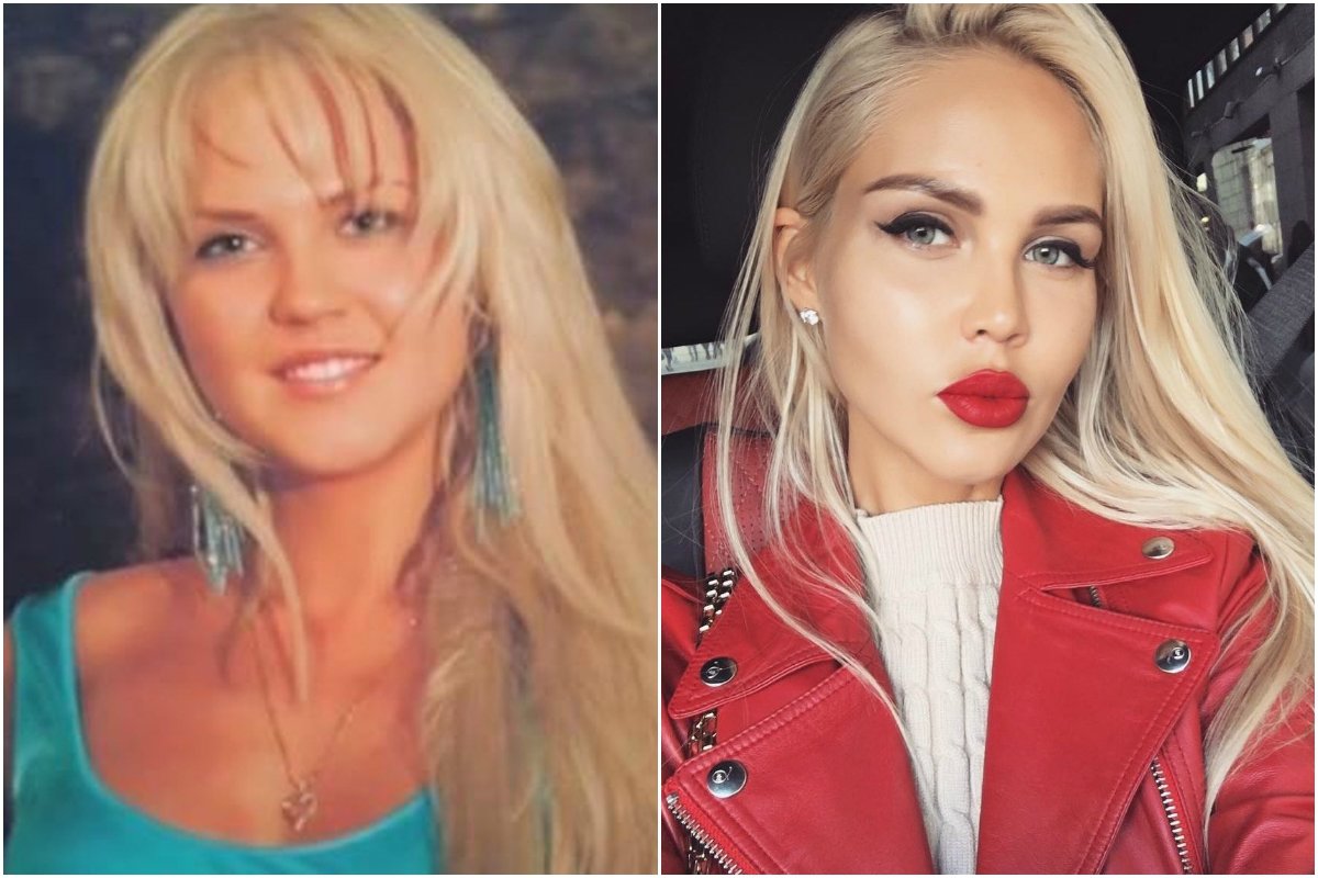 Ханна без пластики фото до и после